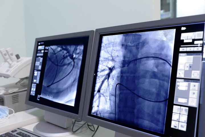 Faster, clearer, smarter: How AI is transforming cardiac imaging